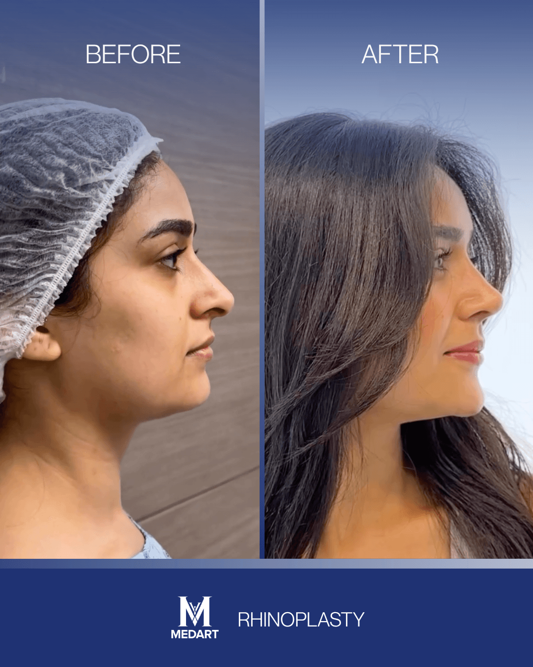 Before After transformation 10
