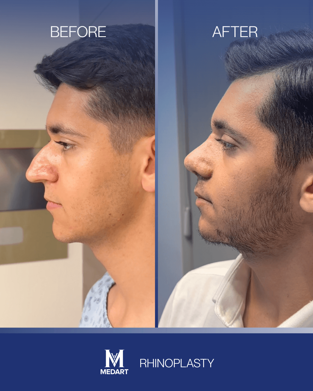 Before After transformation 8